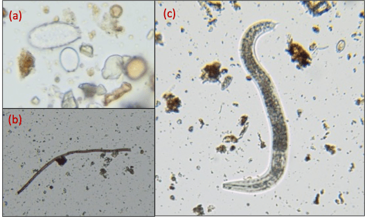 Secrets of Healthy&nbsp;soil
